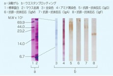 Transfer Protein/Hybridization Membrane Filter