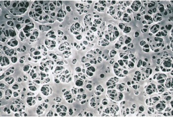 Coated Cellulose Acetate Membrane Filter (Coated Type)